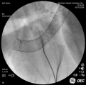 Click image for larger version

Name:	CVS pic 4 09-09.png
Views:	87
Size:	397.4 KB
ID:	63368